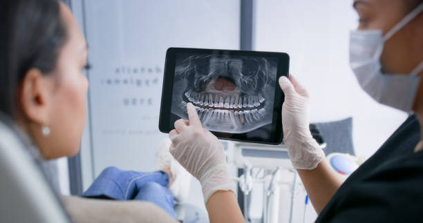 Licensed Tooth Extraction service in Staten Island, NY - Smile Center Dentistry